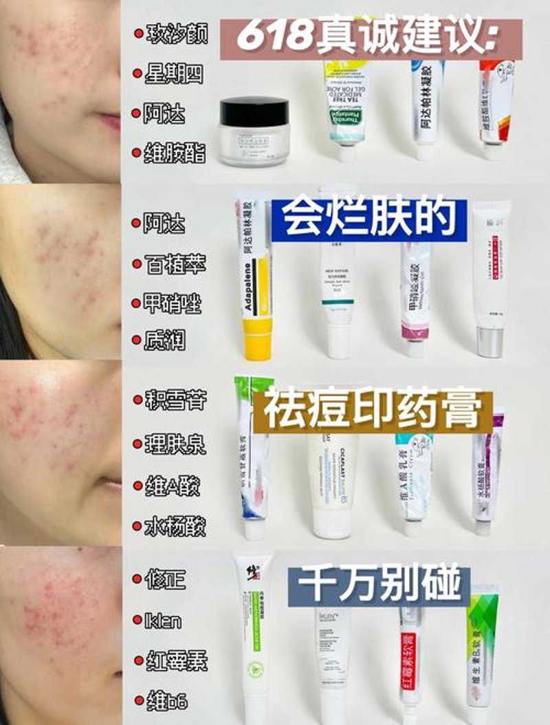 祛痘新趋势：从传统疗法到科技前沿